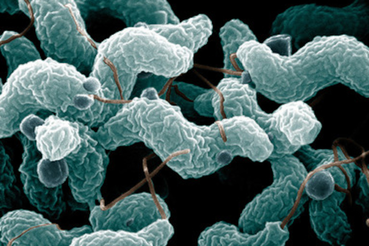 'Campylobacter bacteria' by Microbe World is licensed with CC BY-NC-SA 2.0. To view a copy of this license, visit https://creativecommons.org/licenses/by-nc-sa/2.0/ 